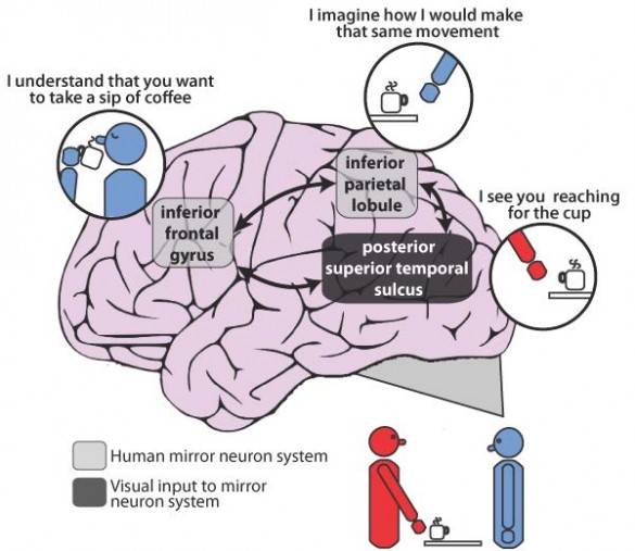 brain-mapping-confirms-patients-with-schizophrenia-have-impaired