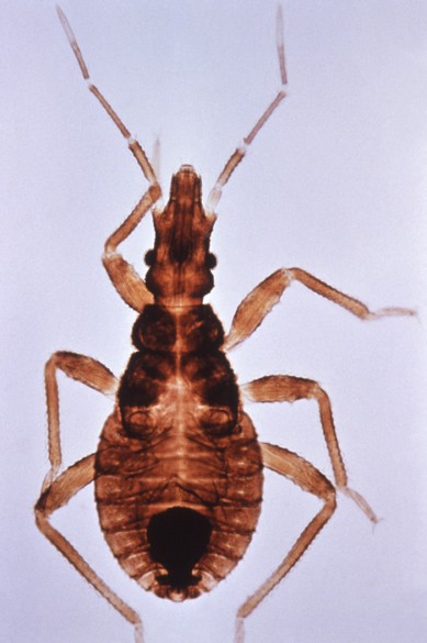 Cure in sight for kissing bug’s bite | Vanderbilt News | Vanderbilt