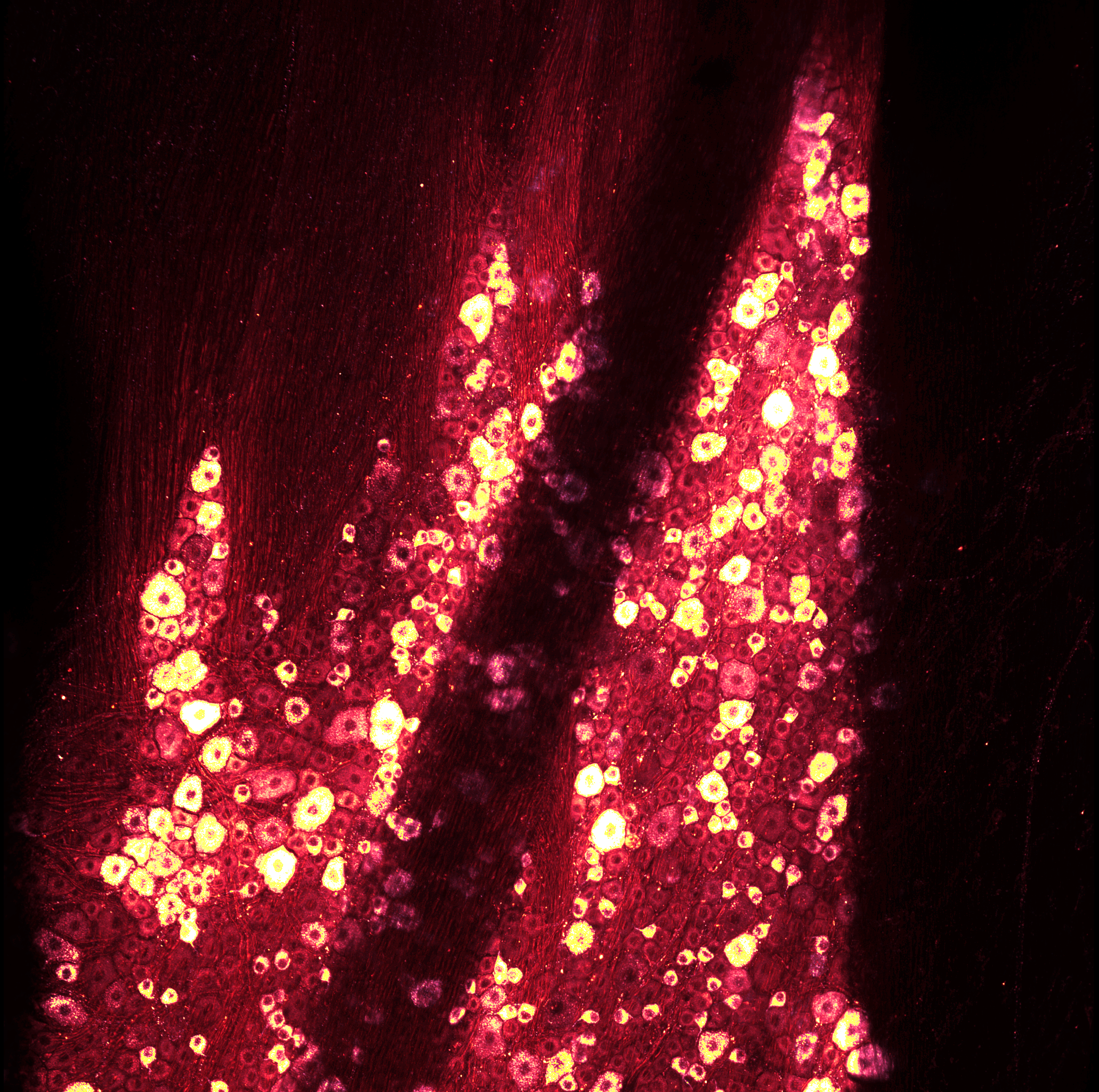 Two-photon image of TRPV1 expressing cells in the trigeminal ganglion