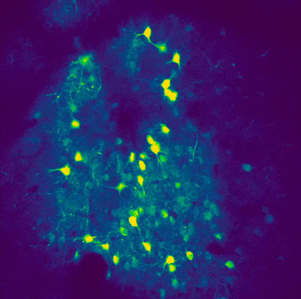 Vanderbilt University