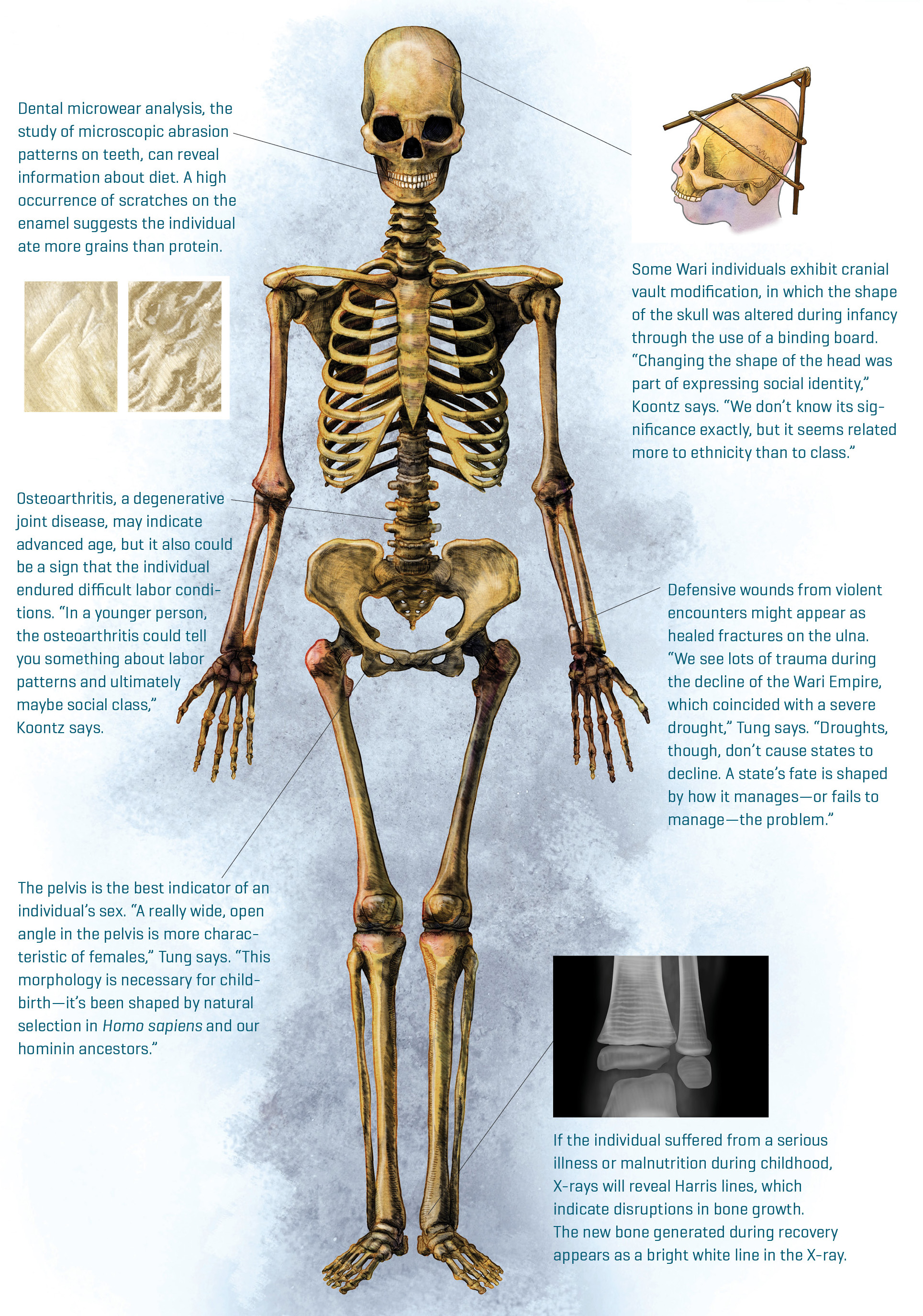 How to study a skeleton: Expert advice from anthropology professor Tiffiny  Tung | Vanderbilt University